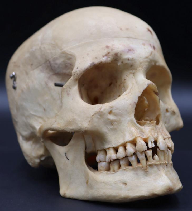 Antique Medical Human Skull. (1 of 13)