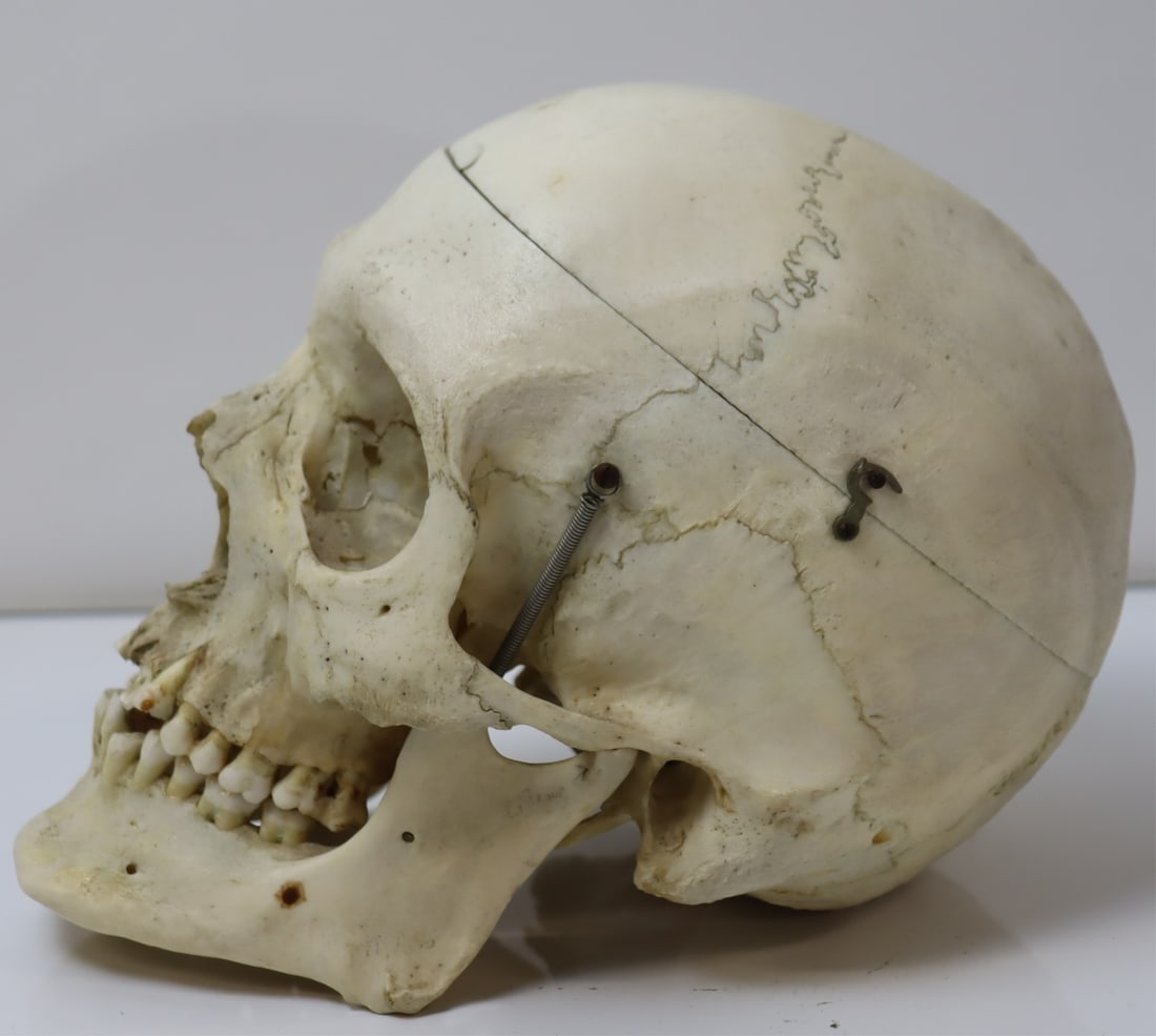 ANTIQUE MEDICAL HUMAN SKULL. (1 of 6)