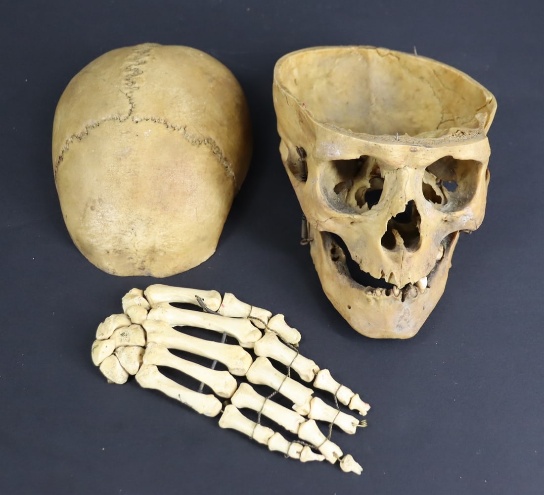 Vintage Human Medical Skull And Hand. (1 of 11)