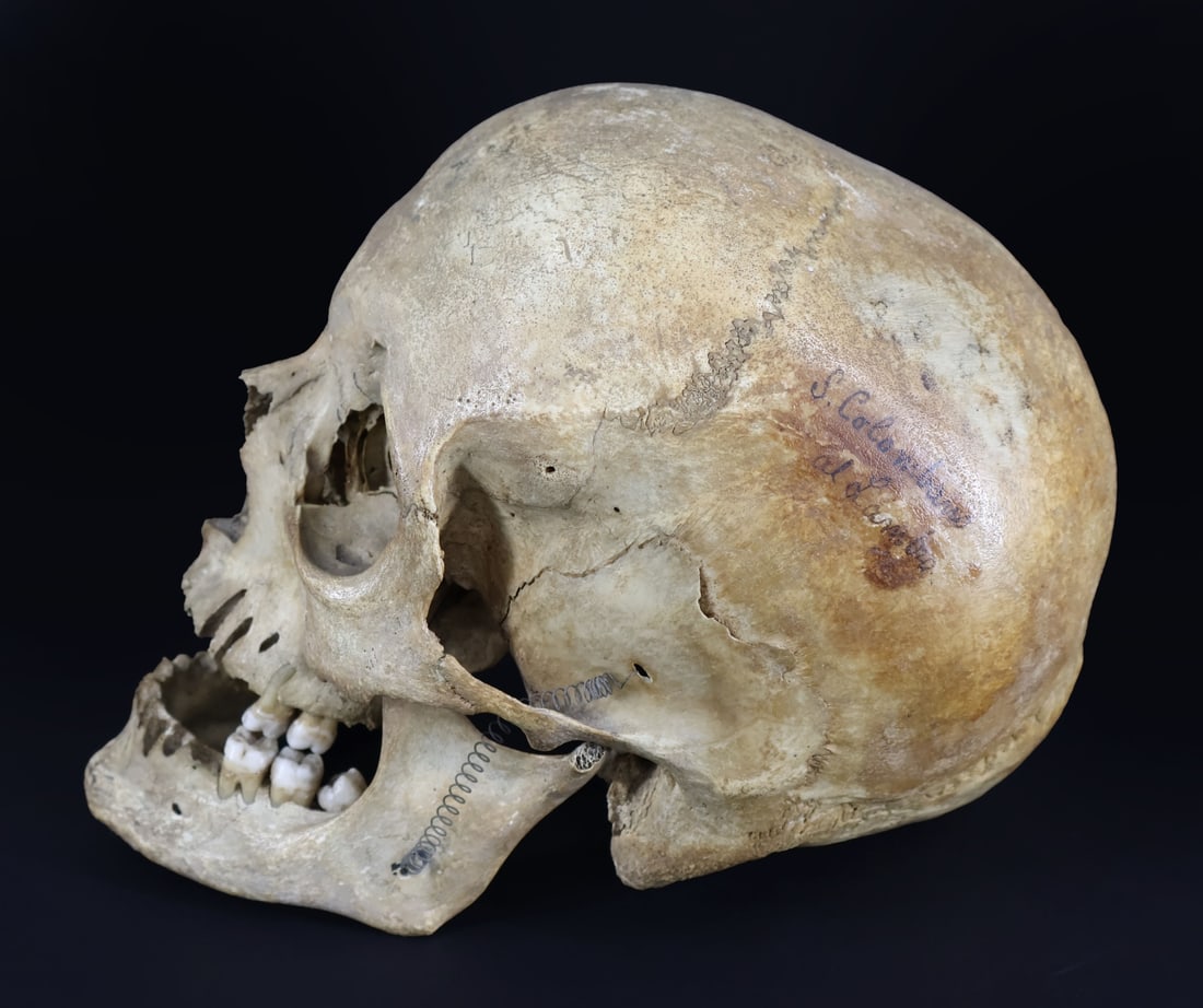 Antique Italian Medical Human Skull. (1 of 7)