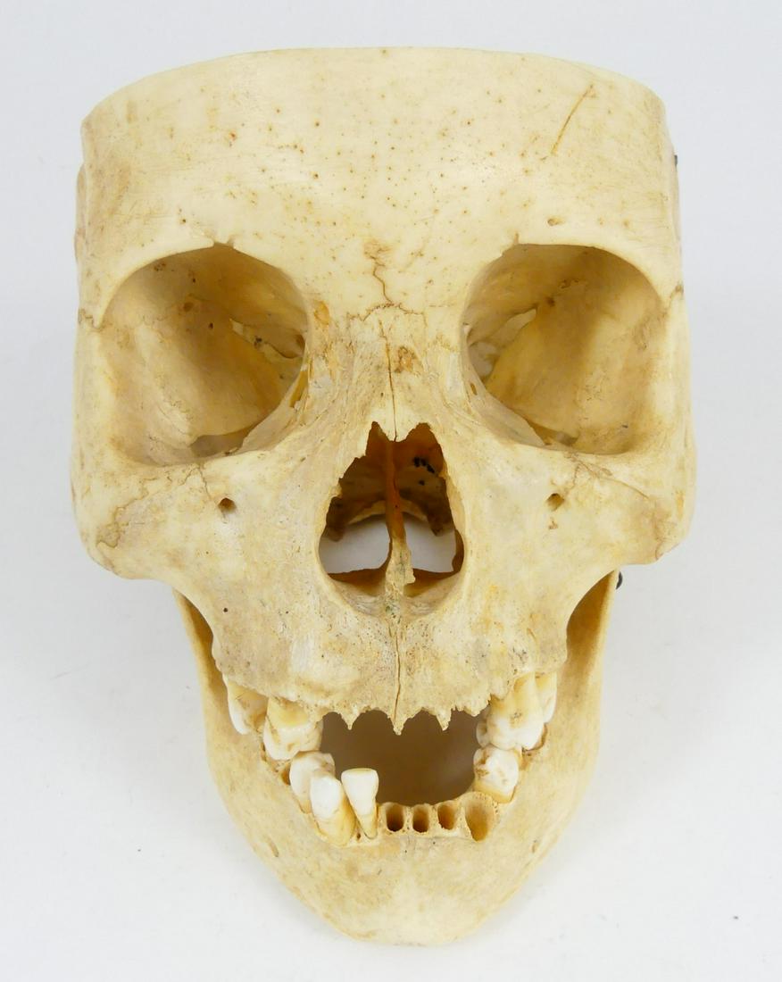 ACADEMIC HUMAN SKULL w ARTICULATED JAW (1 of 6)