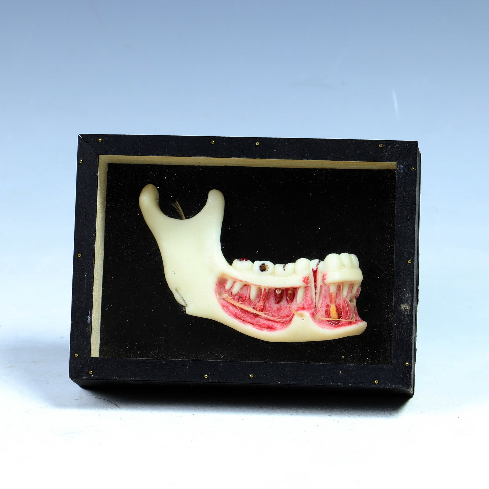 Vintage dentition model in a shadow box: Vintage dentition model section of lower jaw in a shadow box, names of teeth are in latin on the back, 6X4.5X1.5 inches