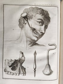 1763 SURGERY ANATOMY ILLUSTRATED ANTIQUE MEMOIRES L'ACADEMIE ROYALE DE CHIRURGIE