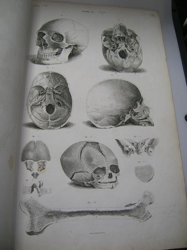 LIZARS (JOHN) A SYSTEM OF ANATOMICAL PLATES OF THE - 7