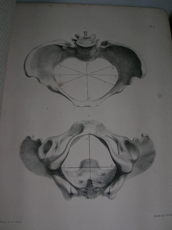 DAVIS (DAVID) THE PRINCIPLES AND PRACTICE OF OBSTE - 4