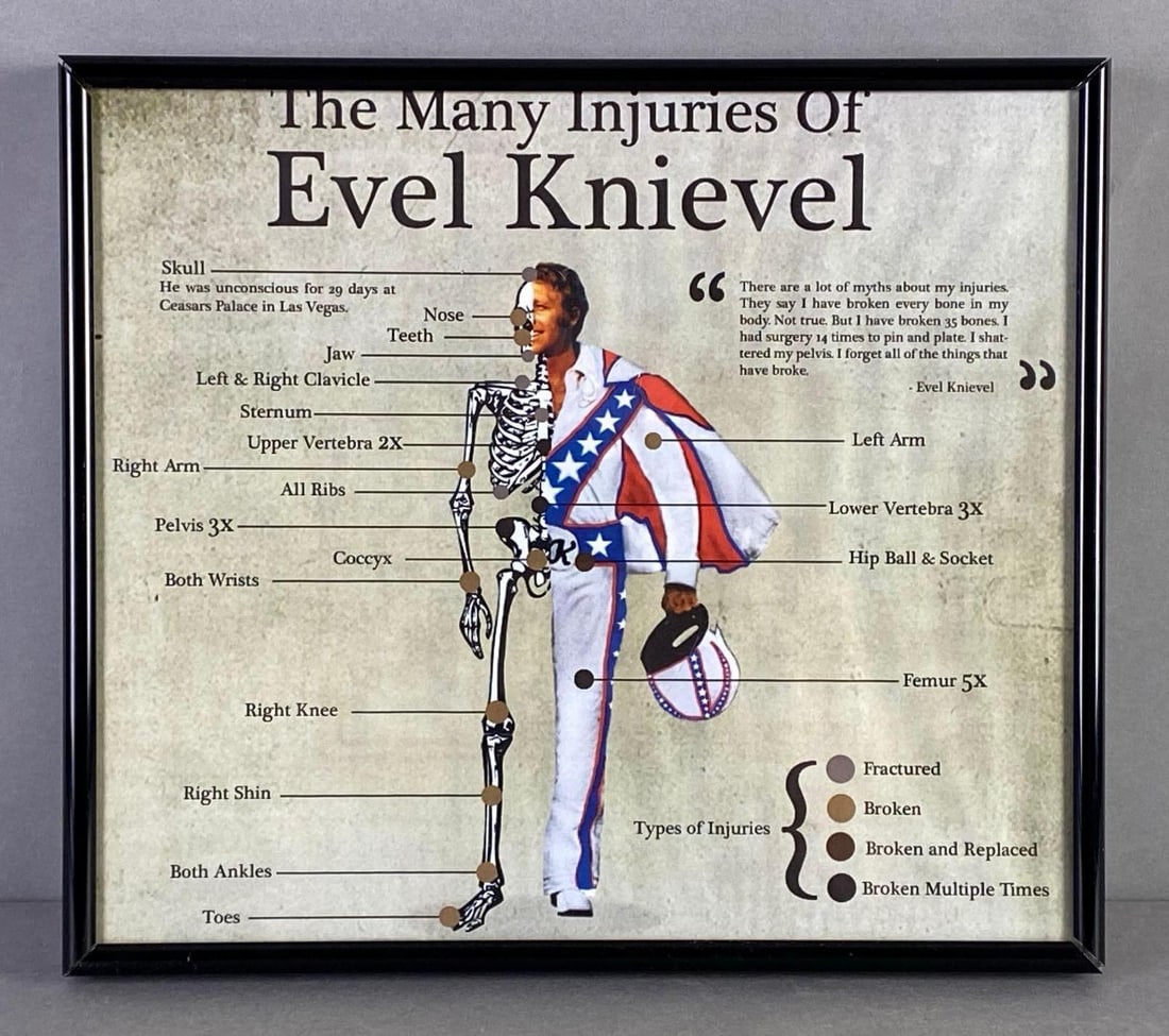 The Many Injuries of Evel Knievel Art Print (1 of 2)