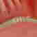 item-51159676=5