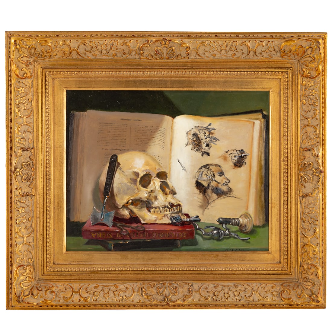 Bernard M. McGibbon. "Trephination of Skull," oil (1 of 5)