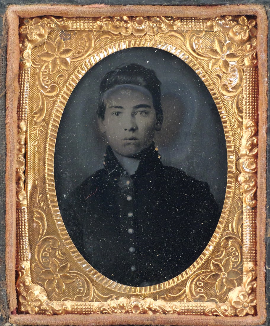 Civil War Union Soldier Tintype: Tintype depicting a young man in Union jacket. Hand embellished hair, possibly with one eye overpainted, gold gilt accented buttons. Leather covered wood case, both sides present. Ninth plate, approx.