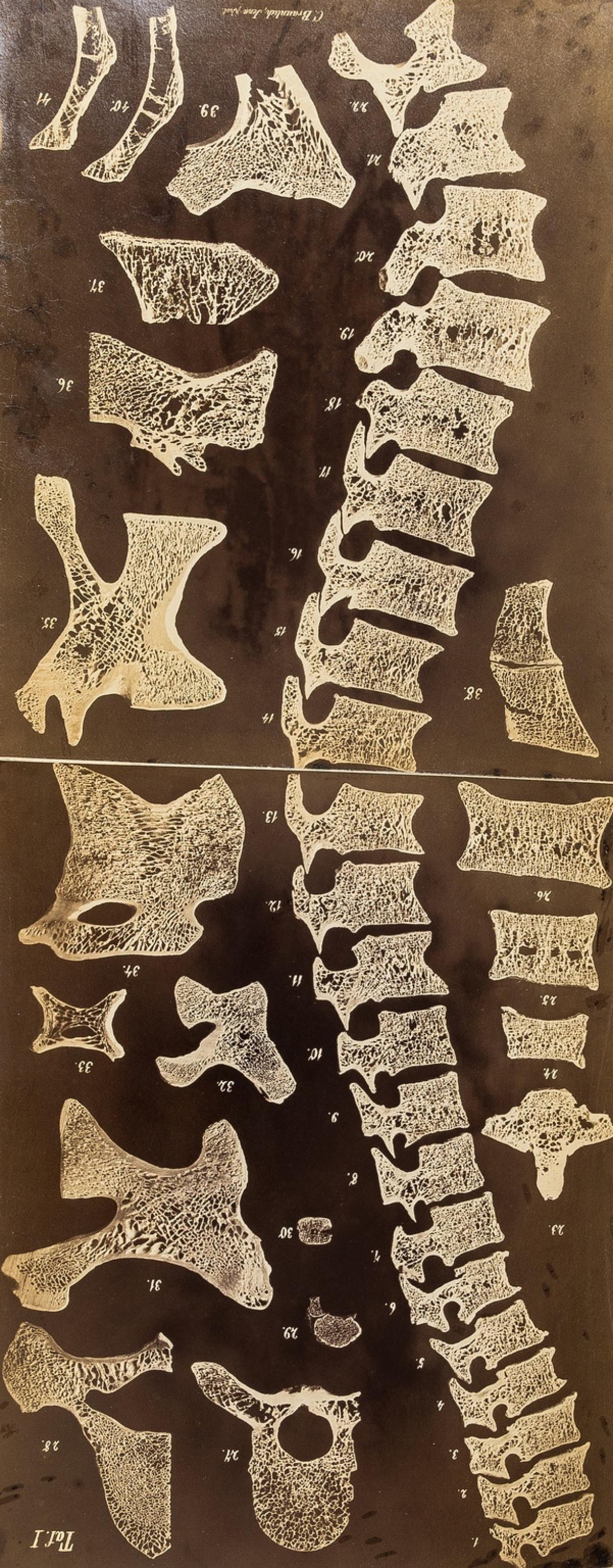 Anatomy.- Bardeleben (Dr. Karl) Beitrage zur Anatomie (1 of 1)