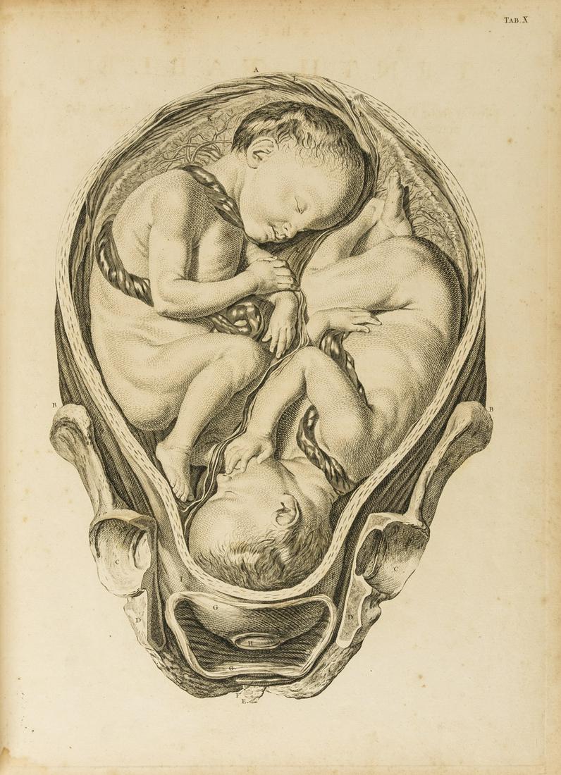 Smellie (William) A sett of anatomical tables...midwifery, first edition, 39 engraved plates, 1754. (1 of 1)