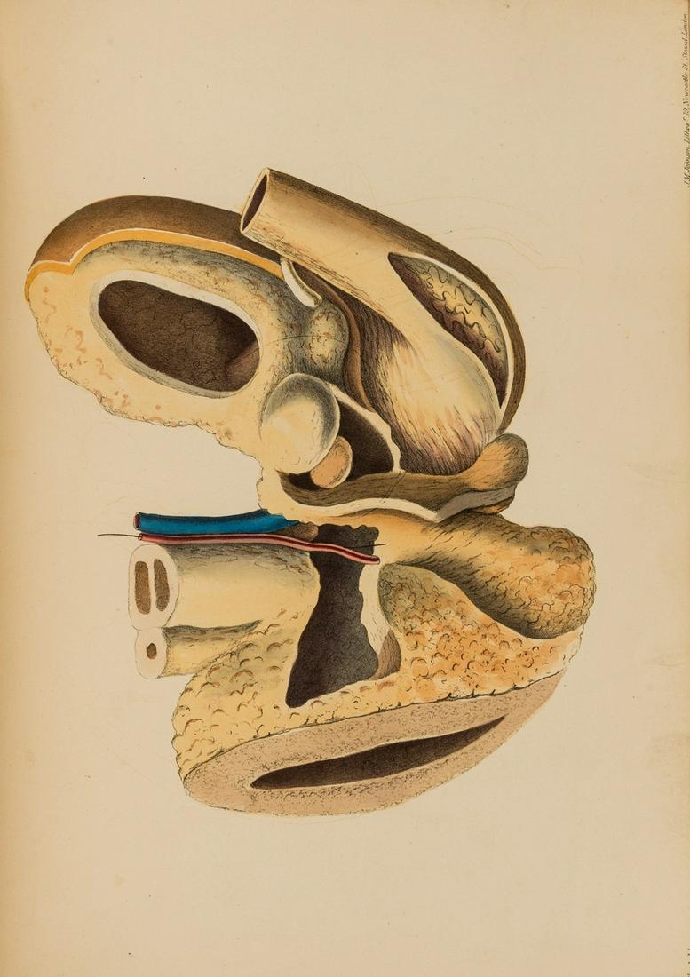 Lithotomy.- Douglas  (James) The History of the Lateral Operation: or, an Account of the Method of (1 of 1)