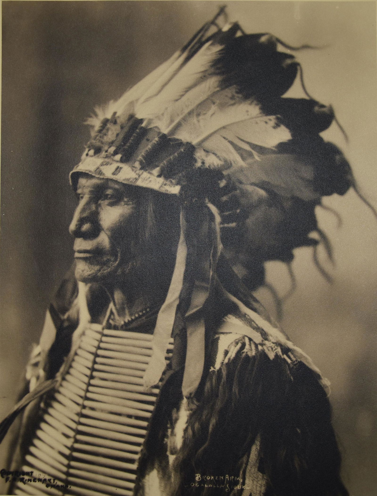 Broken Arm, Warrior Photo Print, Late 1800s-Early 1900s (1 of 2)