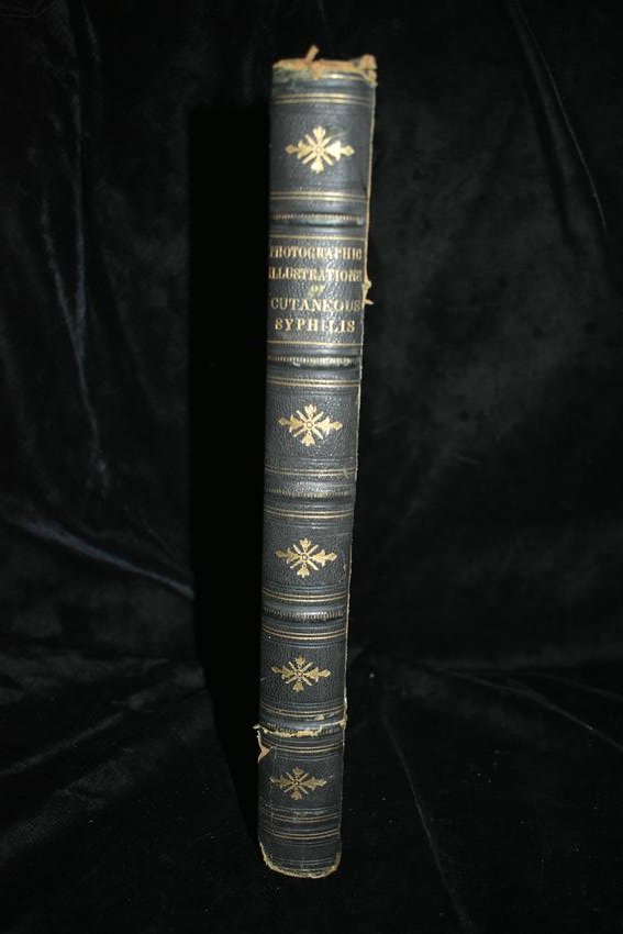 Illustrations of Cutaneous Syphilis 1st Ed 1881: Photographic Illustrations of Cutaneous Syphilis 1881. Photographic Illustrations of Cutaneous Syphilis by George Henry Fox. New York: E. B. Treat 1881 1st Edition. Hand Colored pages. This book is lo