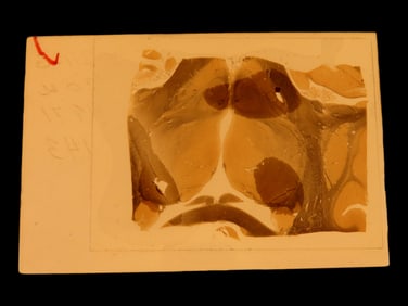 Wooden Box containing Used Microscope Slides-Unknown Use