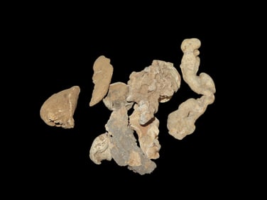 Grouping Of Civil War Metal Detecting Finds Of Boyd Cole,Found In Wayne Co Tennessee