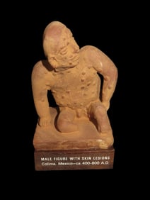 Pre Columbian Portrait/Figure Skin Lesions Colima Mexico Ca. 400-800 A.D.