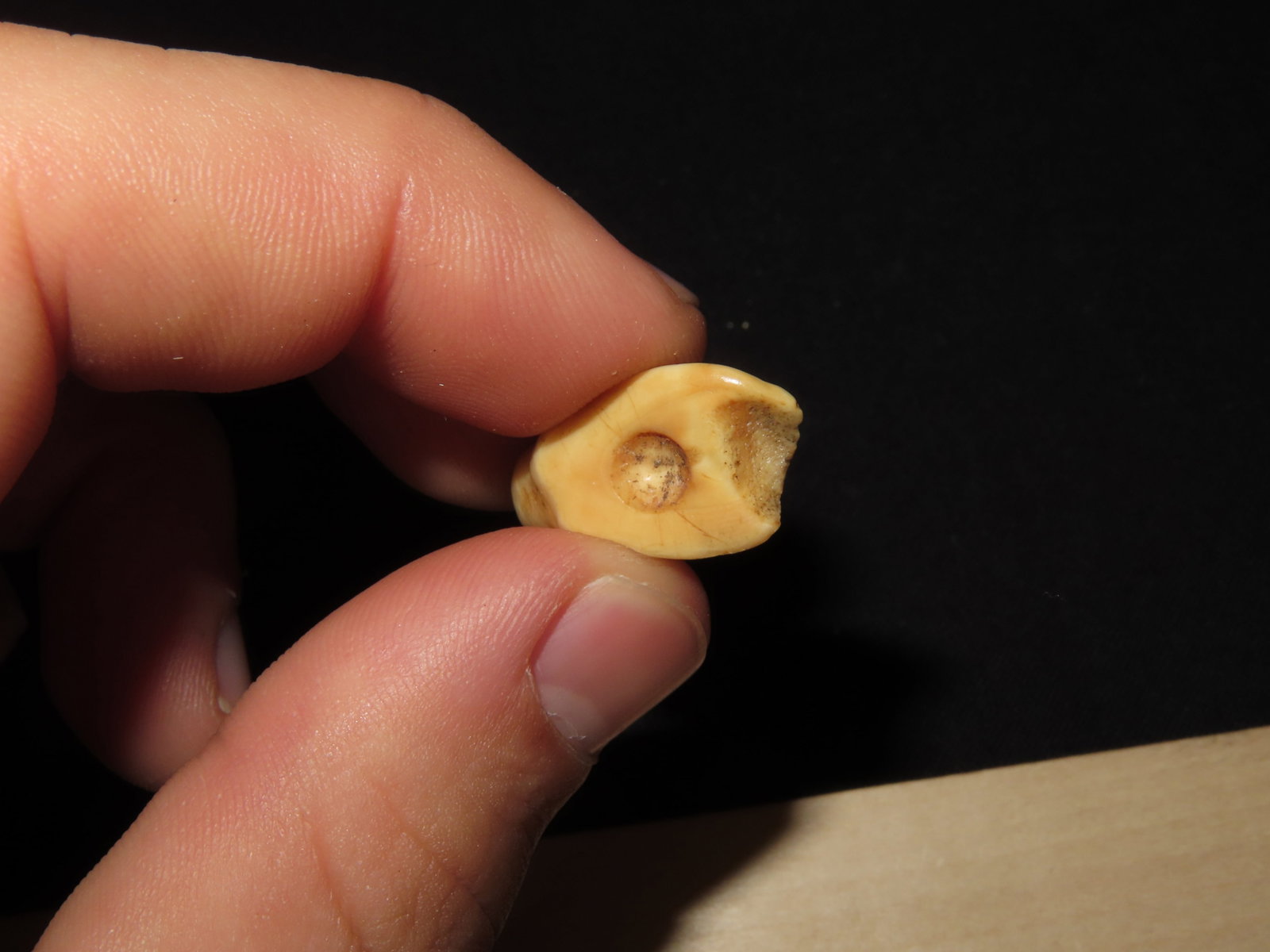 Drilled Teeth, Eskimo, Teller, Alaska - 2