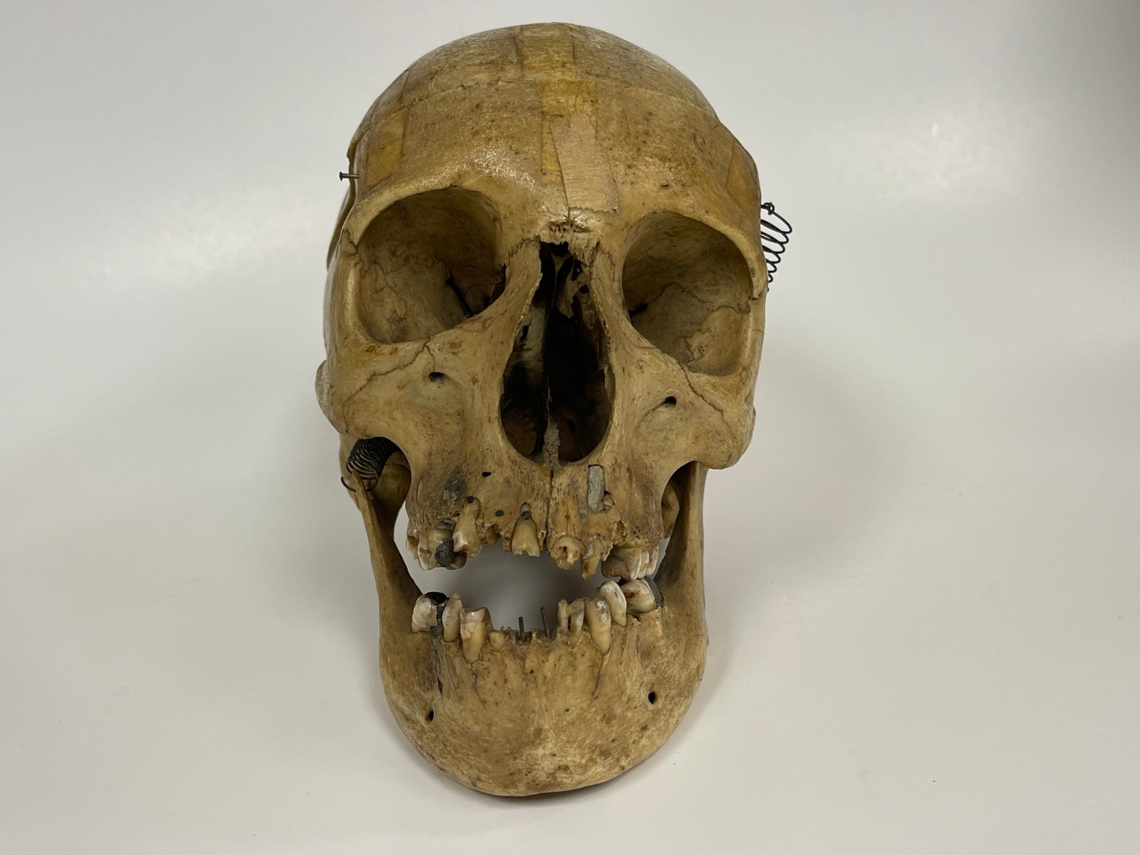AUTHENTIC HUMAN SKULL SPECIMEN - 2