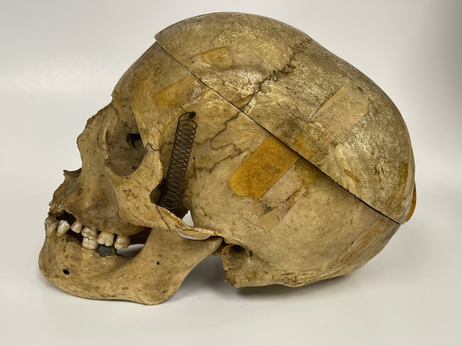 AUTHENTIC HUMAN SKULL SPECIMEN - 3