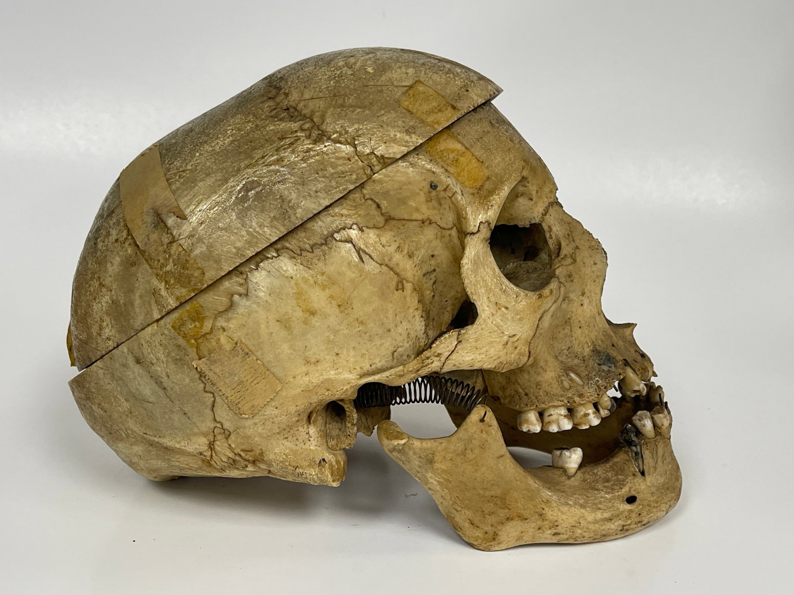 AUTHENTIC HUMAN SKULL SPECIMEN - 4