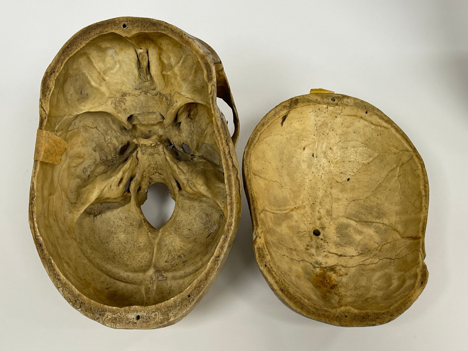 AUTHENTIC HUMAN SKULL SPECIMEN - 5