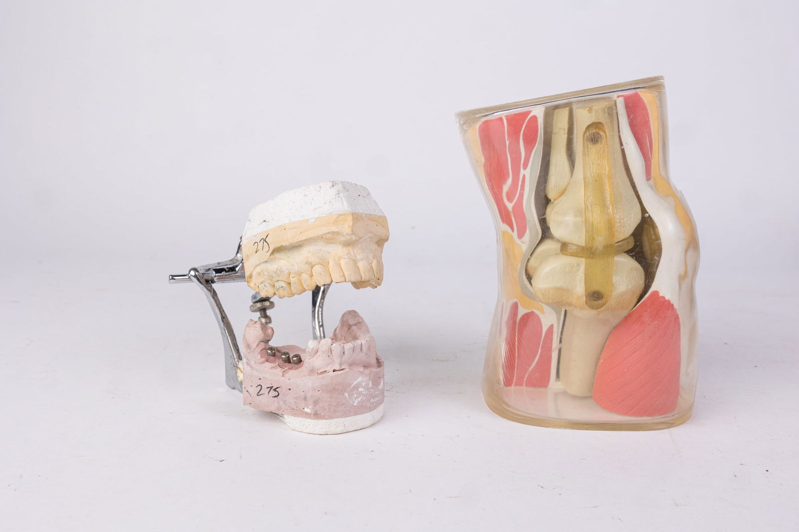 Medical Dioramas: Teeth Mold & Knee Structure: Medical Dioramas: Teeth Mold & Knee Structure</...