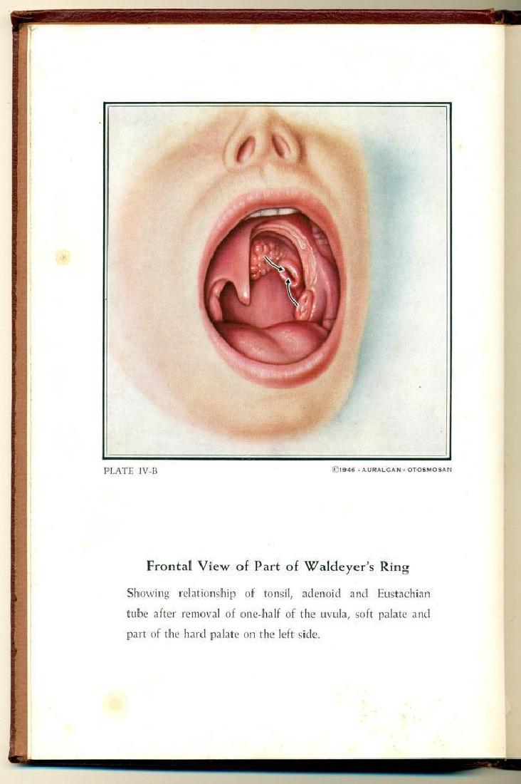 1946 Aural Atlas by Campbell Auralgan Research Division: 1946 AURAL ATLAS by CAMPBELL MD & AURALGAN RESEARCH DIVISION NYC Illustrated EAR Old Vintage Medical Book with Illustrations, "An Aural Atlas" by Ralph G. Campbell, M.D. Published by Auralgan Research