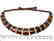 Wide collar Baltic amber cherry&honey necklace 20mm x - 7