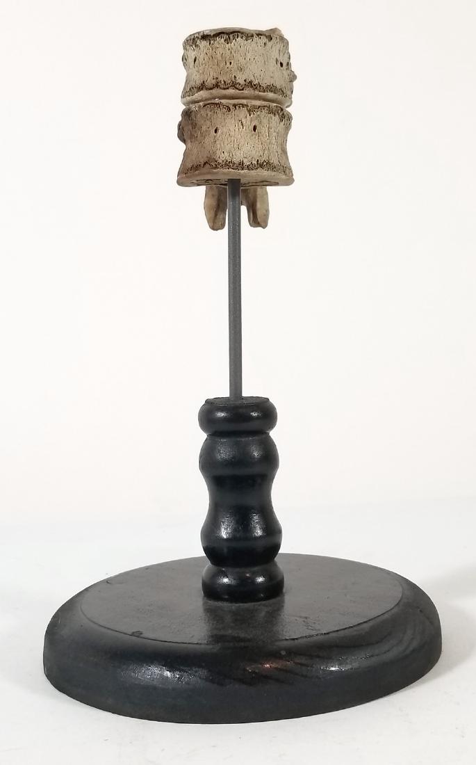 Medical Model Human Spine Pair of Vertabrae (1 of 6)