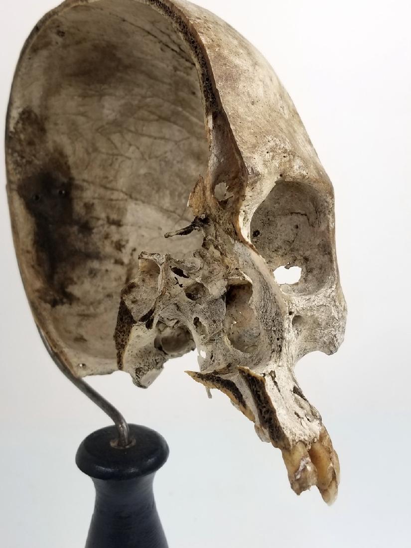 Medical Study Half Human Skull (1 of 10)