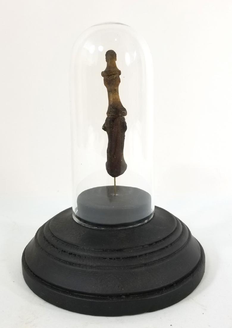 Mounted Human Thumb Medical Study (1 of 3)