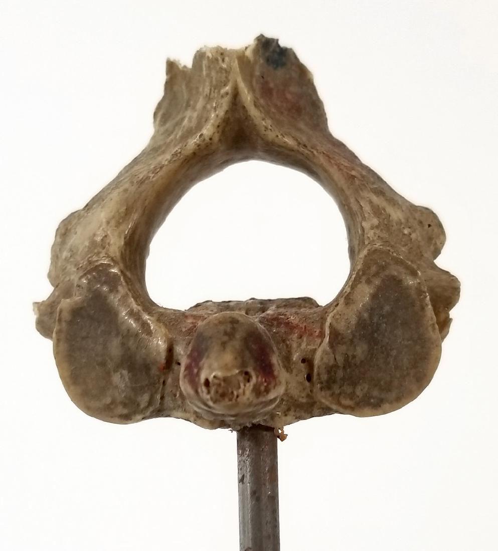 Medical Model Human Spine Single Vertabrae (1 of 2)