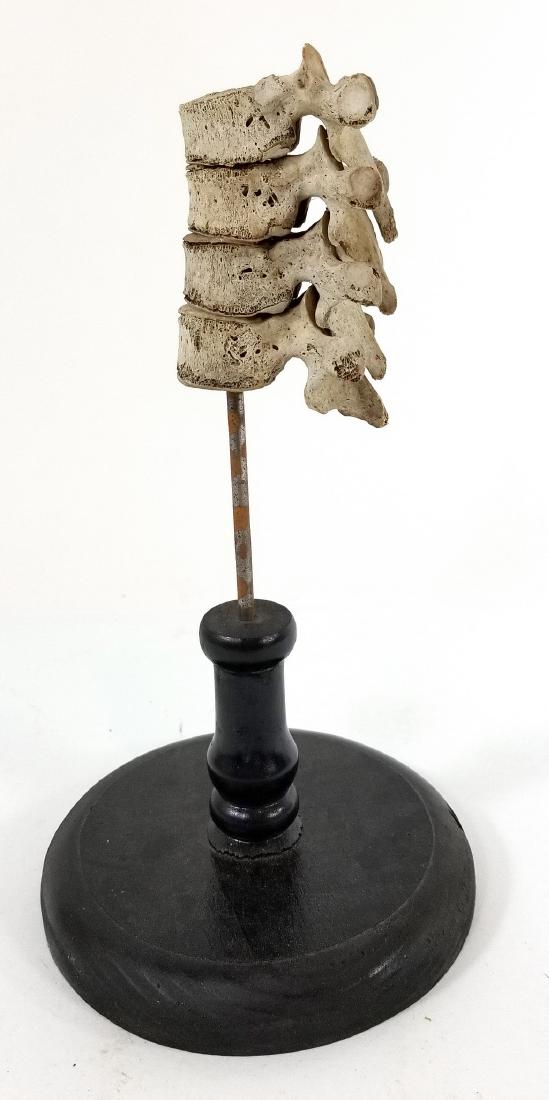 Medical Model Human Spine Four Vertabrae (1 of 5)