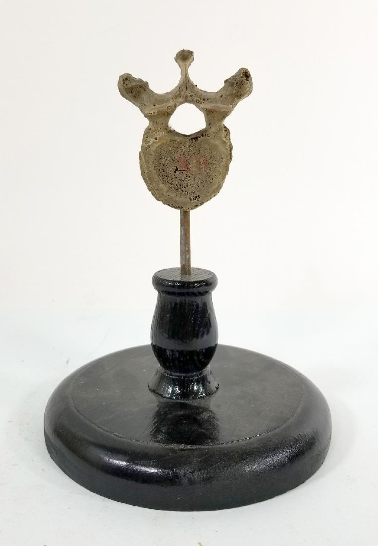 Medical Model Human Spine Single Vertabrae (1 of 3)