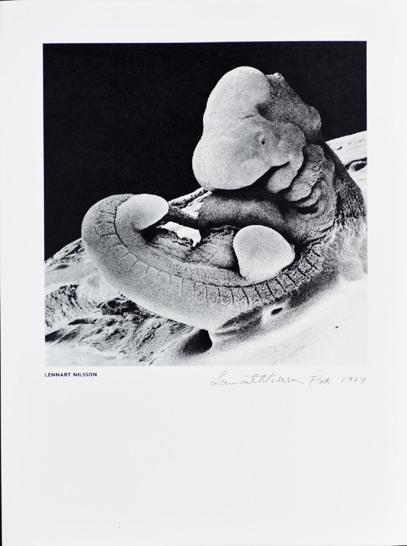 LENNART NILSSON - A month old human embryo 1974: Artist: LENNART NILSSONTitle: A month old human embryo 1974 Date Printed: 1974 Medium: Limited edition duotone vintage print on hand-made double weight paper, type very white, 320 grams. Printer Locat