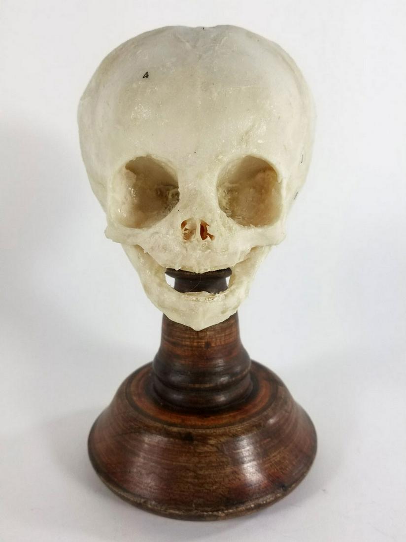 Plastinated Fetal Skull: Title: Plastinated Fetal Skull Description: An authentic medical grade specimen human fetal skull. Mounted on a turned wood plinth, the skull has ben preserved in a resin coating allowing it to be han