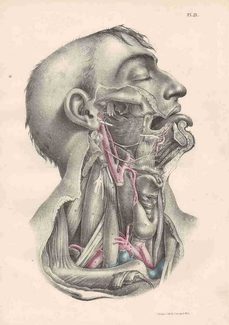 Collectible medical engraving, Maclise 1870 (1 of 4)