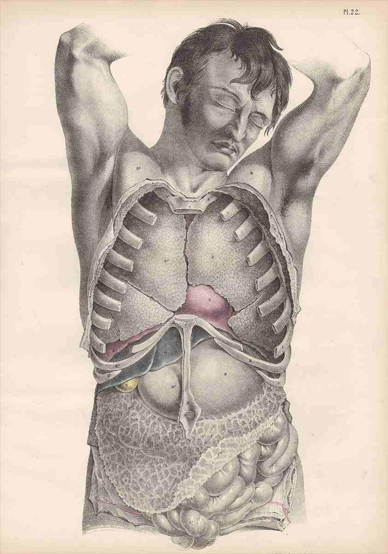 Vintage medical engraving, Maclise 1870 (1 of 3)