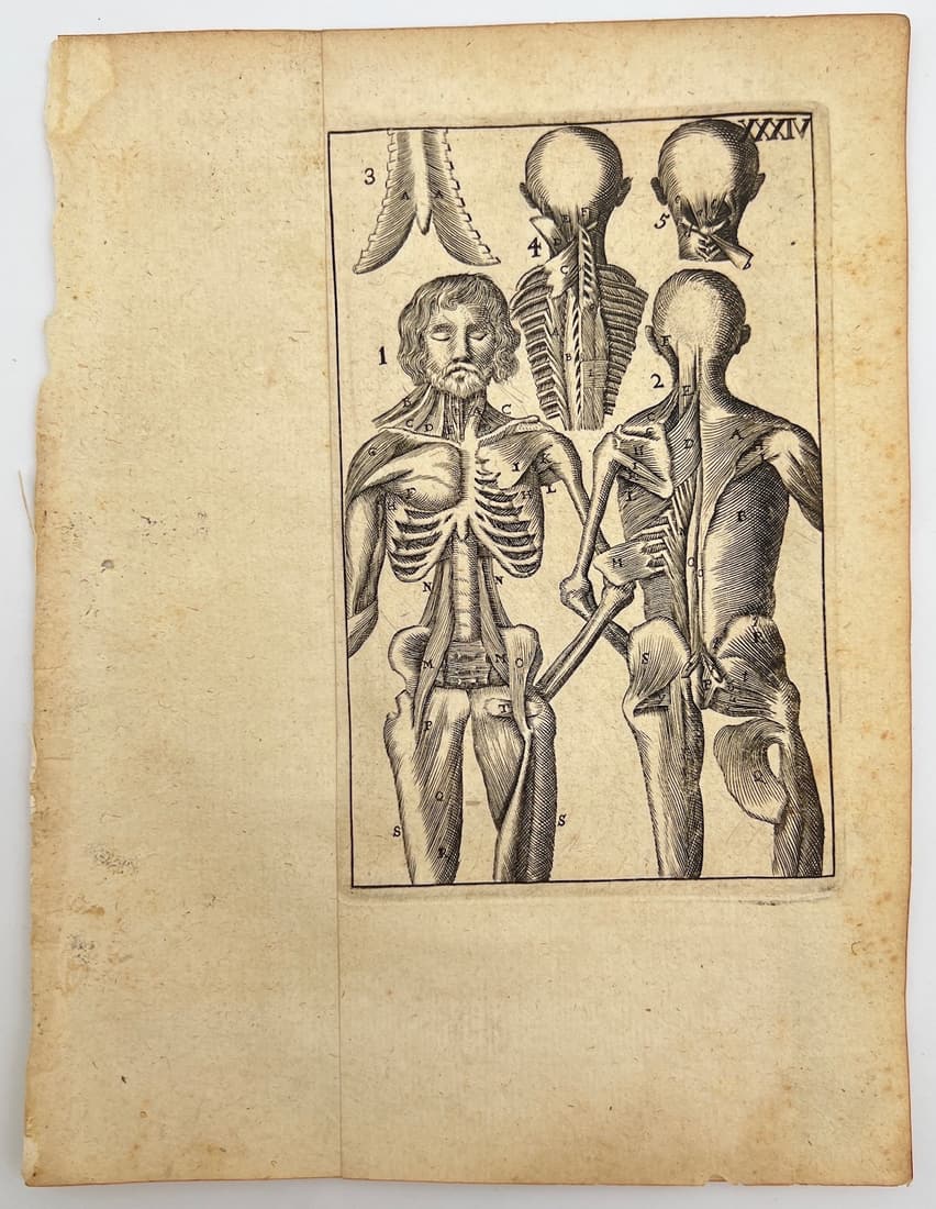 Antique Anatomy Print - Human Skeleton - Plate XXXIV - Philip Verheyen - Belgium (1 of 2)