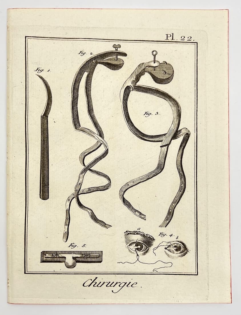Antique Print - Anatomy - Ancient Surgical Instruments - Eye - Benard - France (1 of 1)