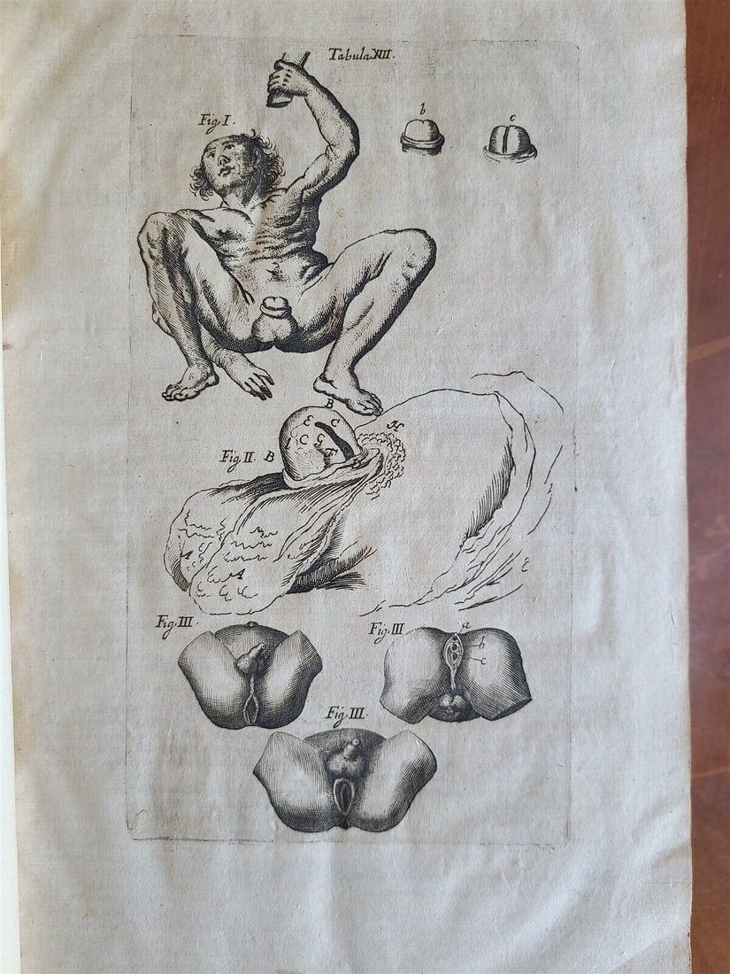 1684 MEDICINA SEPTENTIONALIS antique ILLUSTRATED 17th century medical FOLIO (1 of 20)