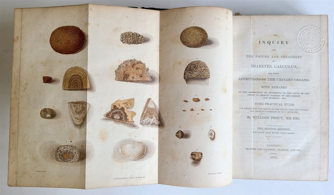 1825 NATURE TREATMENT of DIABETES CALCULUS AFFECTIONS of URINARY ORGANS antique: AN INQUIRY into THE NATURE and TREATMENT of DIABETES, CALCULUS and other AFFECTIONS of URINARY ORGANS : with remarks on the importance of attending to the state of the urine in organic diseases of the