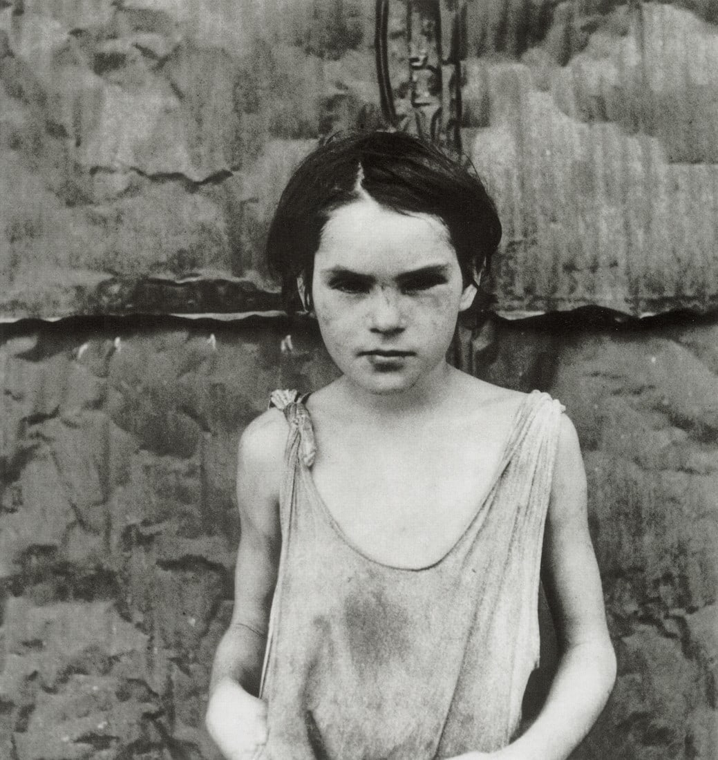 DOROTHEA LANGE - Damaged Child, Oklahoma, 1936: Artist: Dorothea Lange Title: Damaged Child, Shacktown, Elm Grove, Oklahoma, 1936 Medium: Photo Litho, 2002, Italy Dimensions: 7.4x7.85" Description: Heat Wax Mounted on 8.5x11" Conservation Board Art