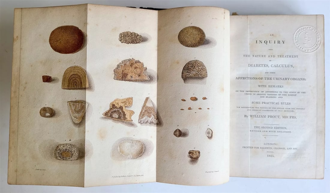 1825 NATURE TREATMENT of DIABETES CALCULUS AFFECTIONS of URINARY ORGANS antique: AN INQUIRY into THE NATURE and TREATMENT of DIABETES, CALCULUS and other AFFECTIONS of URINARY ORGANS : with remarks on the importance of attending to the state of the urine in organic diseases of the