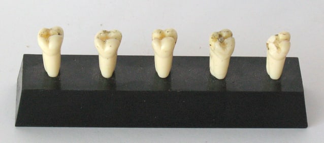 Vintage dental office tooth display.