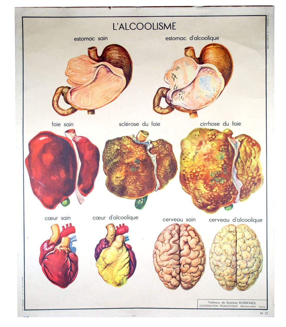 FRENCH school aid poster Rosignol 1950 alcoholism (1 of 3)