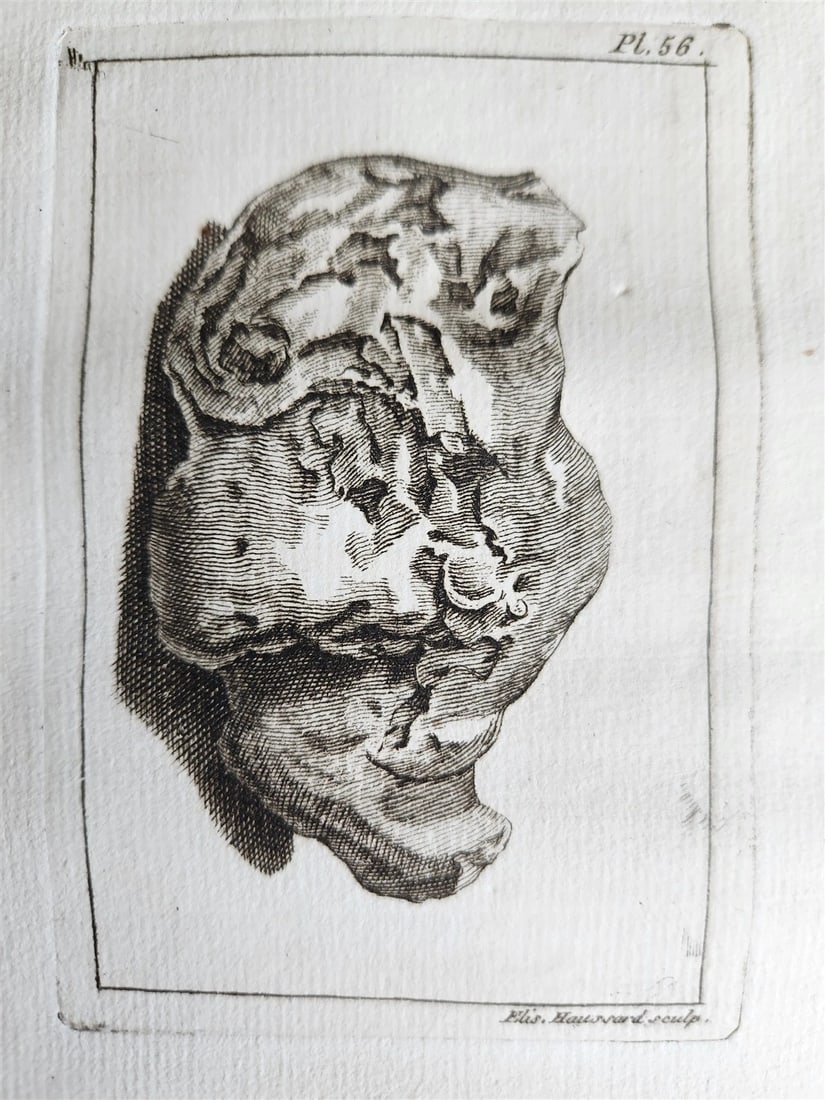 1750 MEDICAL TREATISE ILLUSTRATED ANATOMY by Francois PLANQUE antique V. 3 - 8