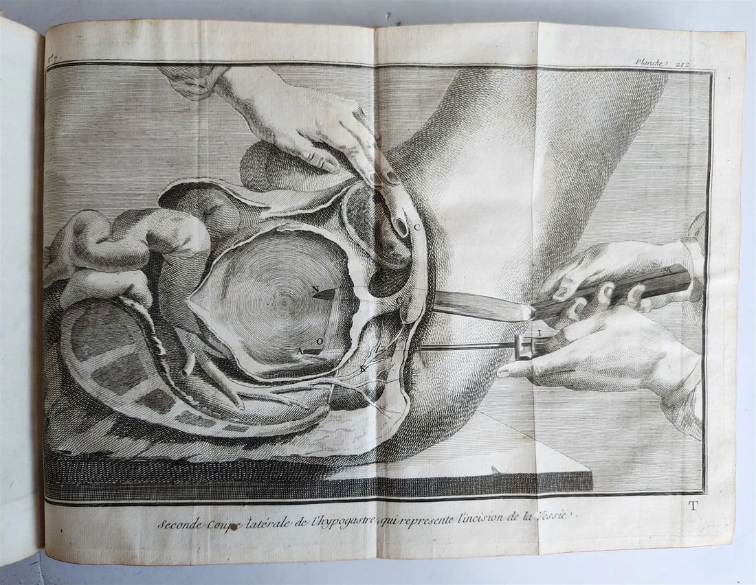 1770 MEDICAL TREATISE ILLUSTRATED ANATOMY by Francois PLANQUE antique V. 10 - 3
