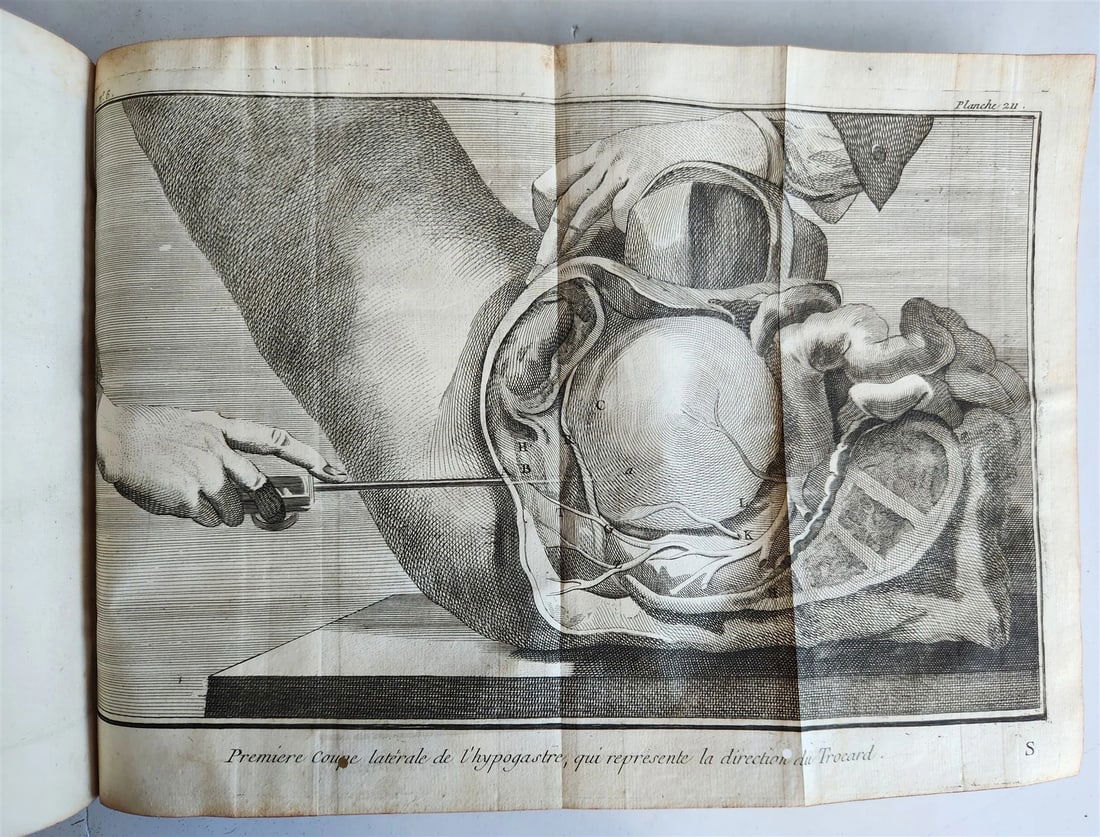 1770 MEDICAL TREATISE ILLUSTRATED ANATOMY by Francois PLANQUE antique V. 10 - 8
